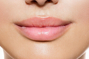Juvedern Ultra Lips