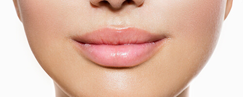 Juvedern Ultra Lips